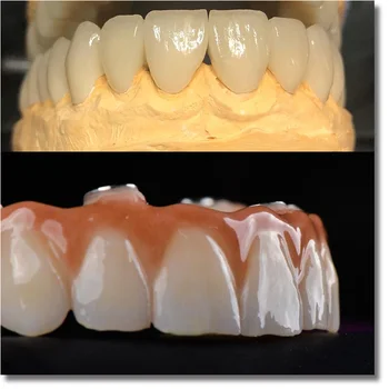 UT extrémne 9514mm najlepší estetický efekt zubných zirconia bloky pre zubné laboratória zirkonzhan